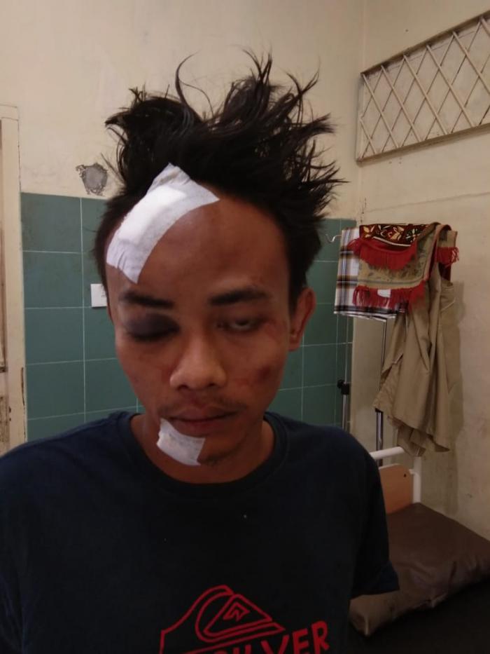 Dua Pelaku Jambret Babak Belur dan Patah Tulang Dihajar Massa