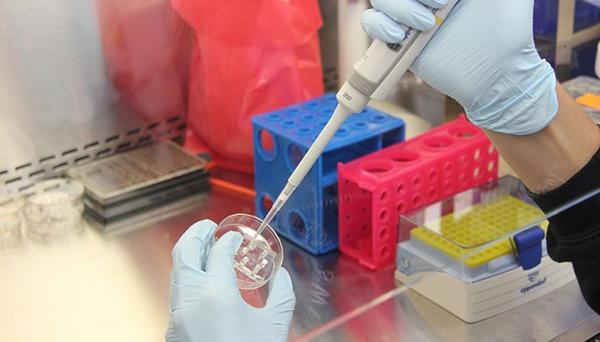 Peneliti, Temukan Pengobatan HIV 