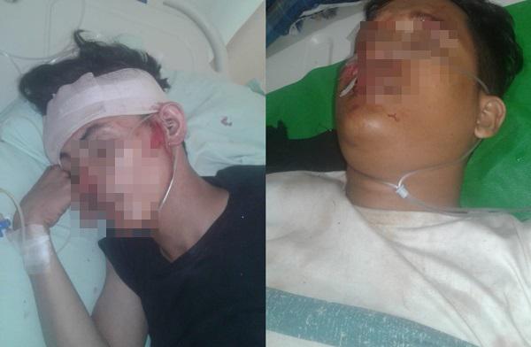 Ditabrak Korban, Dua Pelaku Jambret di Medan Kritis