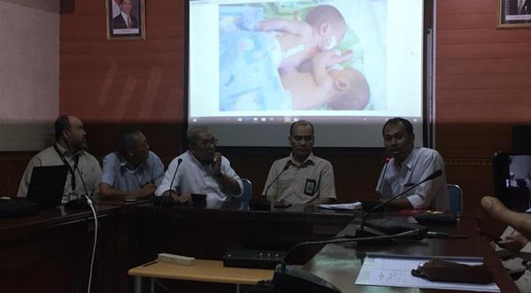 Operasi Dijadwalkan 23 Juli 2019,  Tim Dokter Optimistis Pemisahan Adam-Malik Sukses