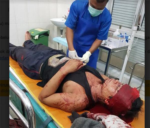 Pembacok Ibu dan Abang di Madina Perlu Diperiksa Kejiwaannya