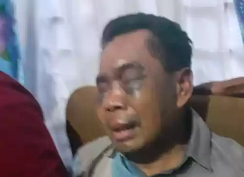 Polda Sumut Selidiki Saksi Polsek Percut Seituan yang Alami Penganiayaan