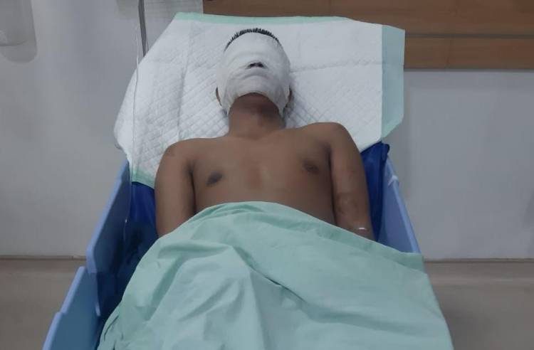 Kabarnya,  Seorang Wartawan  Disiram Air Keras