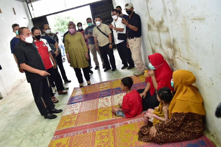 Jenguk Dua Anak Penderita Penyakit Kulit, Edy Rahmayadi Rujuk Haikal dan Zakira ke RS Haji Medan