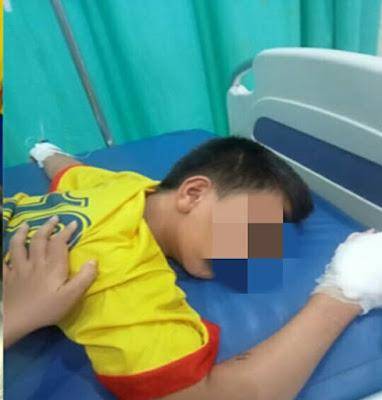 Bocah 13 Tahun 2 Jari Tangannya Putus Ditebas Kelewang Kelompok Perampok