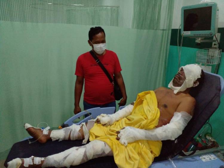 Diduga Gegara Balon Hijau, Satu Unit Warung Bakso Habis Dilalap Sijago Merah