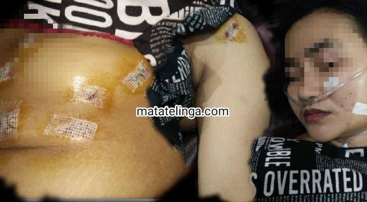 Tikam Pacar.16 Kali,  Gegara Minta Uang Gugurkan Kandungan