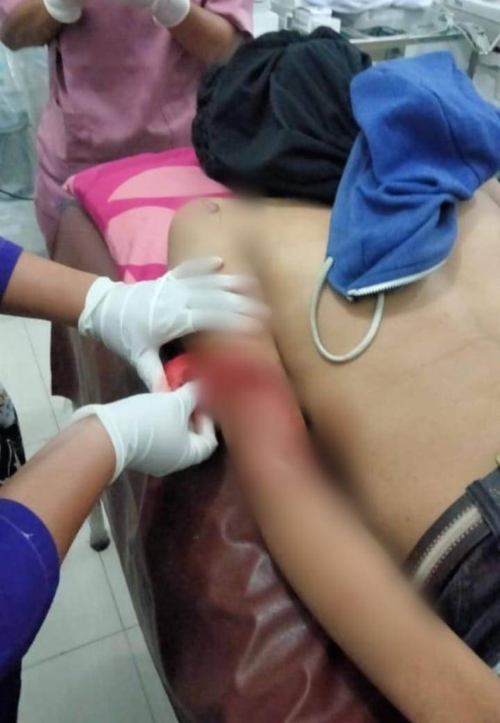 Lengan Anak Marelan Nyaris Putus, Diduga Korban Begal