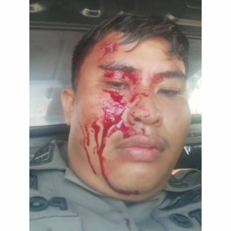 Buntut Penertiban Bangunan di Sampali, Personel Satpol PP Deliserdang Laporkan Kasus Pengeroyokan