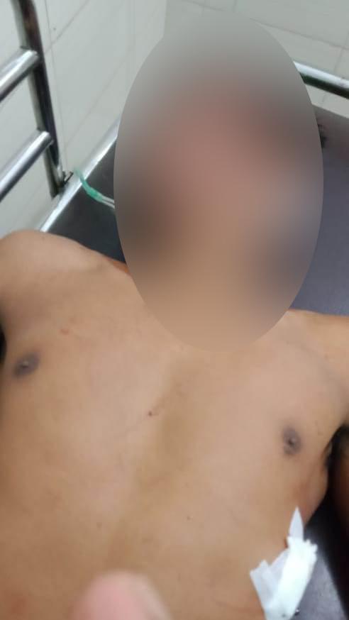 Satu Begal Beraksi di Bandar Khalifah Tewas dihajar Massa