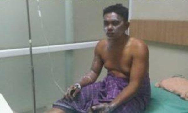 Tungku Tanur Peleburan Meledak, Seorang Karyawan PT Growth Asia Terluka