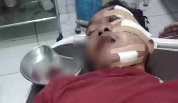 Pengendara Sepeda Motor Luka Berat Tabrak Truk yang Sedang Parkir