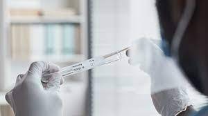 Harga Tes PCR Hingga Antigen Sudah Mulai Turun