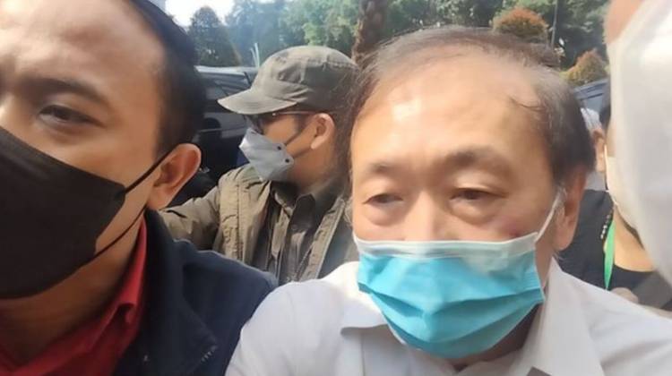 Tersangka Berinisal SD Dugaan Korupsi Rp78 Triliun Dibantarkan