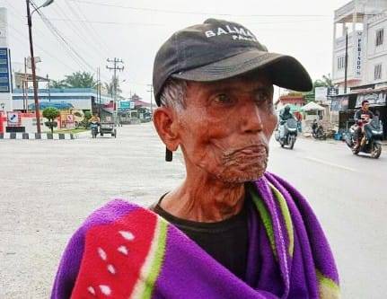 Viral Dimediasosial. Warga Temukan Seorang Pria Tua Diduga Terlantar Di SPBU Kotapinang - Labuhambatu Selatan