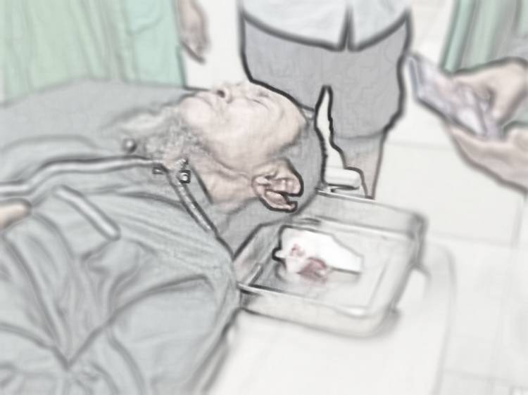 Muazin Masjid Raudhatul Islam Disayat Pisau Karter