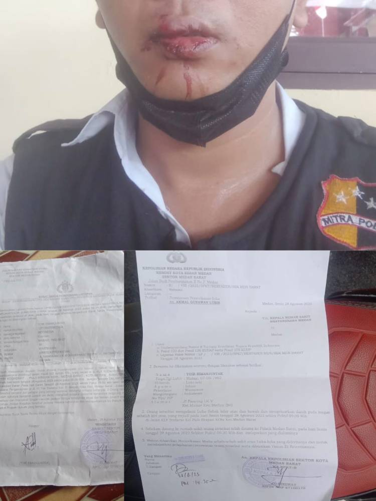 Viral!...Wartawan Mitra Poldasu, Dianiaya dan HP Miliknya Dirampas Pelaku Belum Juga Tertangkap