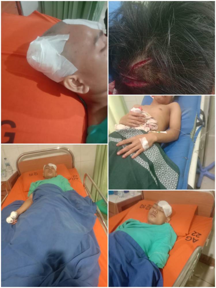 Warga Mabar Dibegal Di Jembatan Metal, Jari Nyaris Putus , Kepala Koyak Bacokan