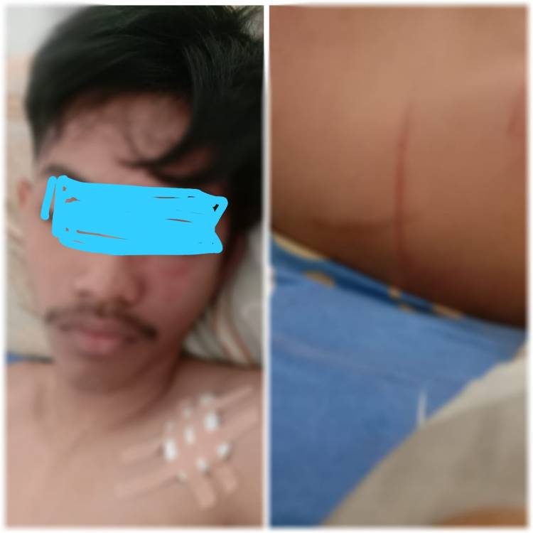 Kasus Begal Marak Lagi, 3 Pemuda Warga Jalan Cokroaminoto Kena Tikam