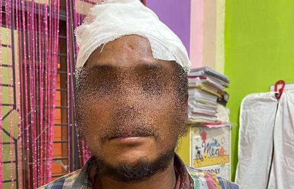 Hendak Perkosa Penumpang, Supir Angkot di Karo Babak Belur Diamuk Warga