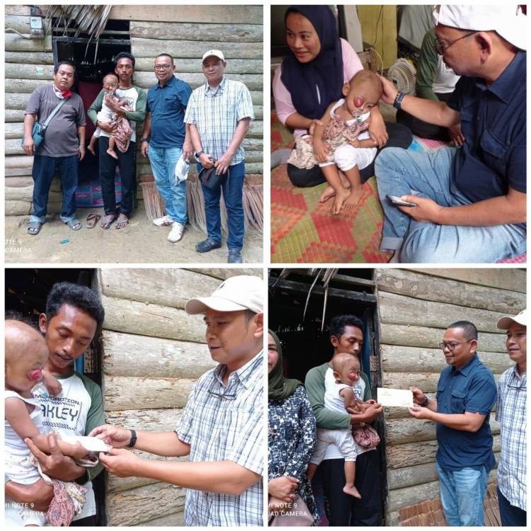 Sedulur Selawase Salurkan Bantuan Kapolres Langkat dan Donatur untuk Bocah Penderita Tumor Mata
