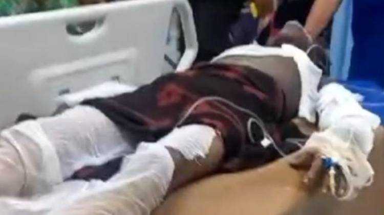 Gegara HP, Seorang Pria di Dibakar di Percut Sei Tuan