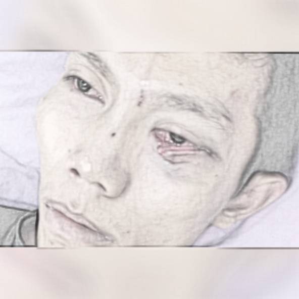 Mata Dicongkel dan Dibegal, Pelakunya Abang Mantan Pacar
