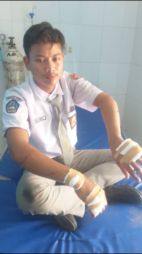 Geger di Perbaungan !!! Dua Pelajar Dibacoki  Sekelompok OTK