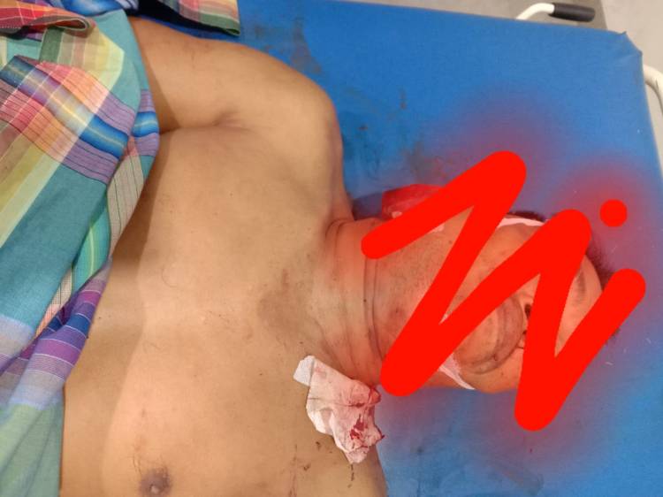 Nyawa Irwan Nasib Melayang Dipistol Polisi Polres Belawan