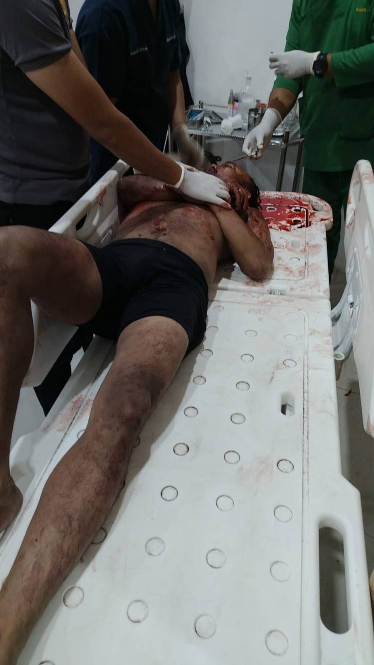 Oknum TNI Sekarat Dimassa, Gara-gara Ini di Sunggal