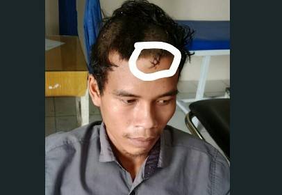 Tunggak Upah Potong Kayu, Kepala Nyaris Terbelah