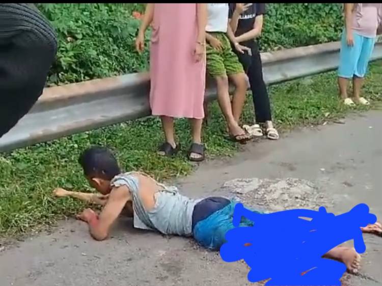 Viral, Pria Diduga Bajing Loncat Tergilas Truk, Dua Paha Remuk di Belawan
