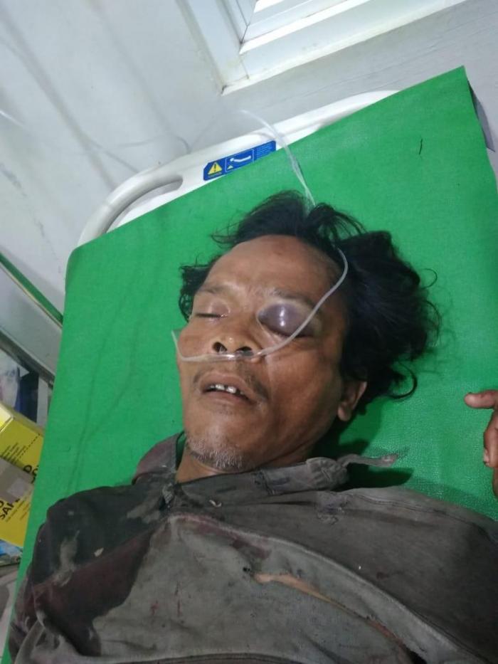 Pria Bertato Diserempet Mobil, Hingga Tewas 