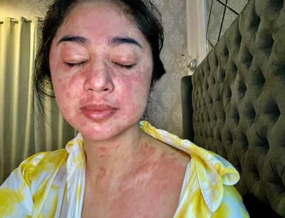Meski Sembuh, Dewi Persit Pisah  Ranjang dengan Suami