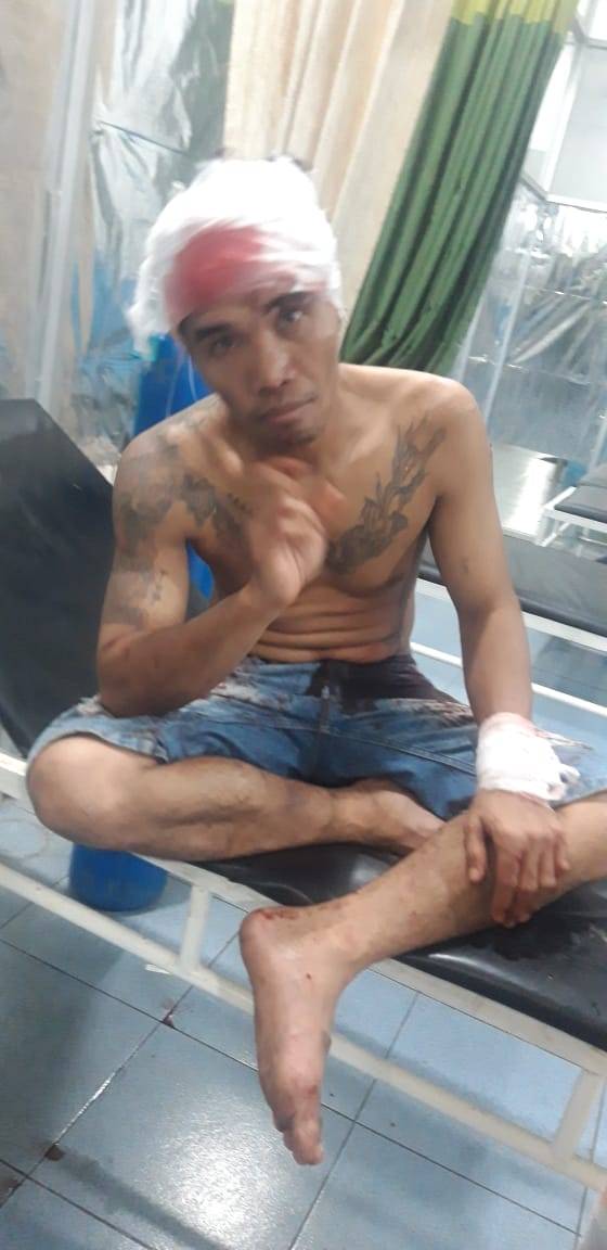 Dibacok OTK, 2 Warga Galang Luka Parah