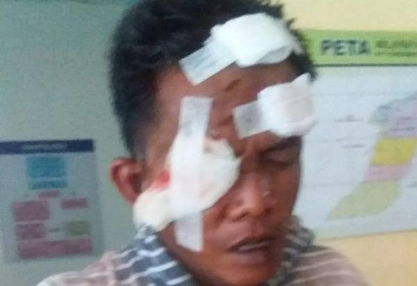 Usai Dipermak Warga, Pelaku Penggelapan Sepeda Motor Diserahkan ke Polisi