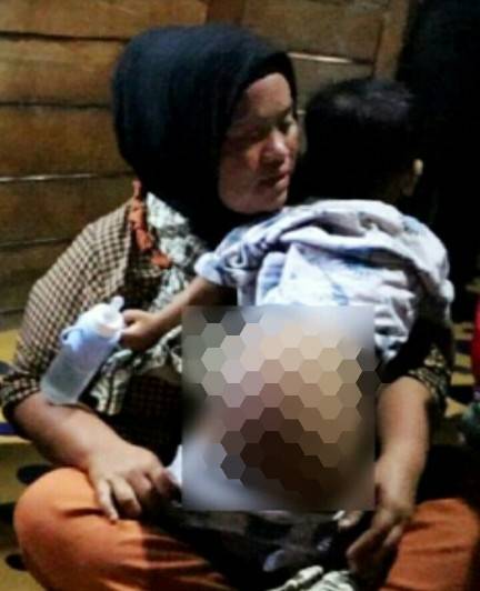 Kapoldasu Biayai Perobatan Bayi Penderita Tumor Asal Labuhanbatu