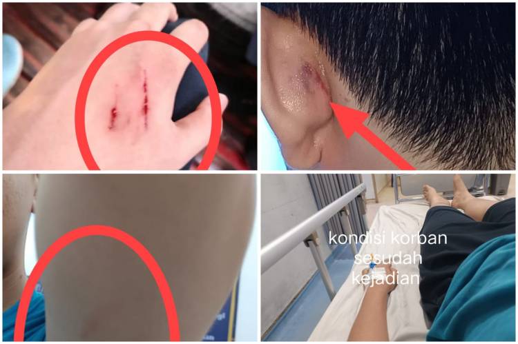 16 Hari Kasus Penganiayaan Anak Tak Berjalan, Orang Tua Korban Minta Kapolda Tangkap Pelaku