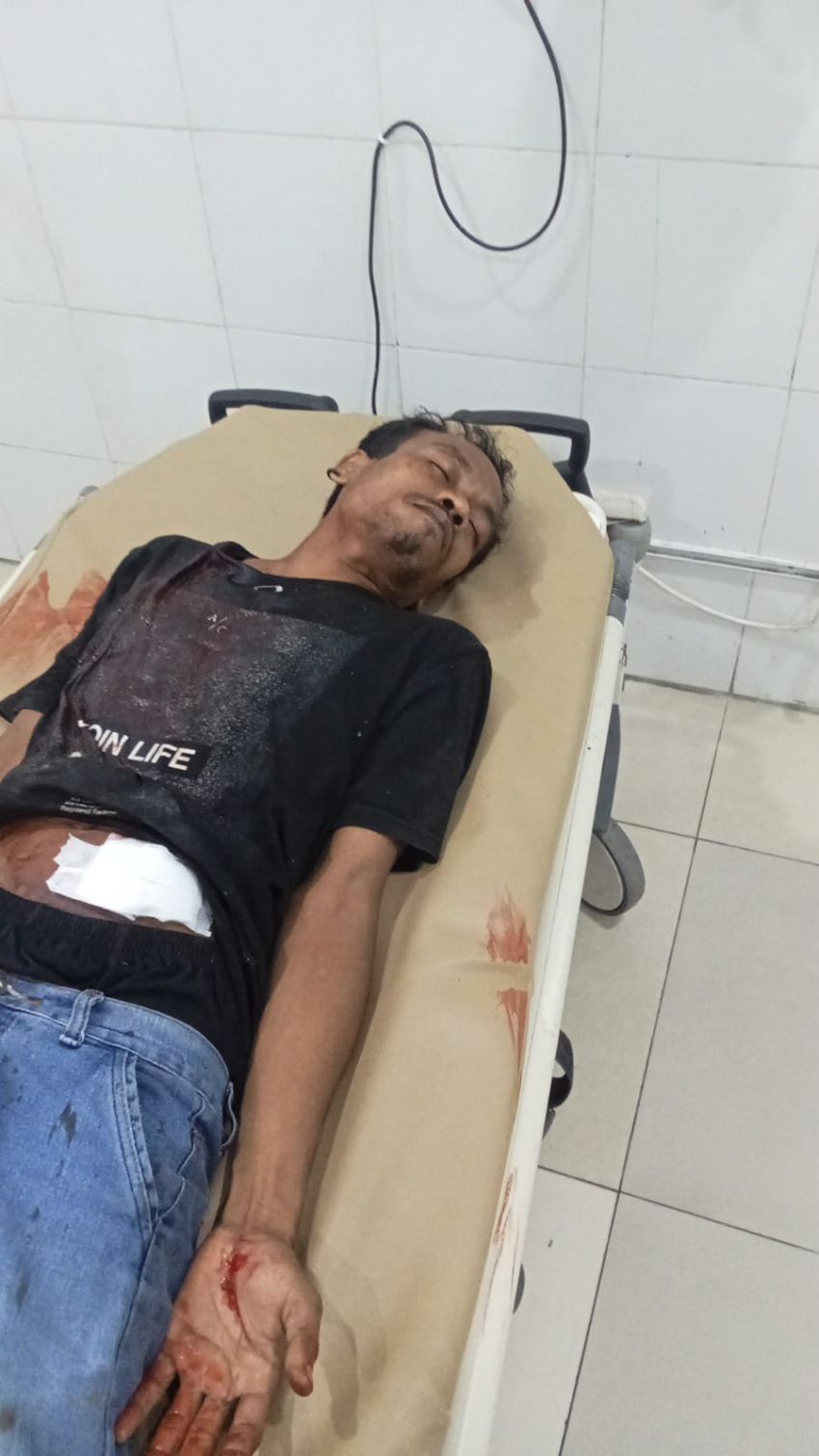 Bentrok Pemuda, Satu Korban Nyaris Tewas Diclurit
