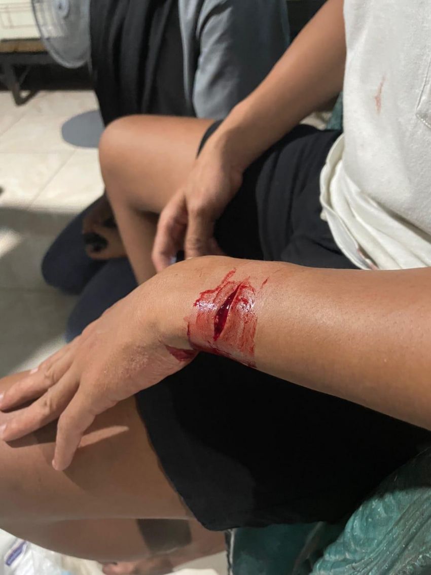 Pasangan Kekasih Dibegal, Korban Dibacok, Motor Dibawa Kabur