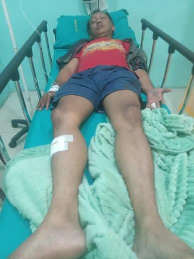 Driver Ojol Dibegal Saat Antar Penumpang ke Bandara, Jari Dibacok, Motor Dirampas