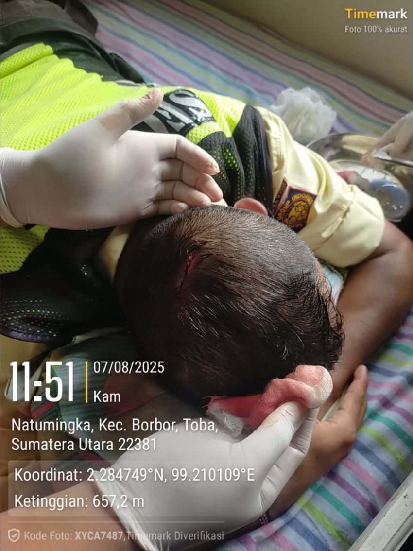 Bentrok Warga Vs PT Toba Pulp Lestari,  Satpam Dibacok