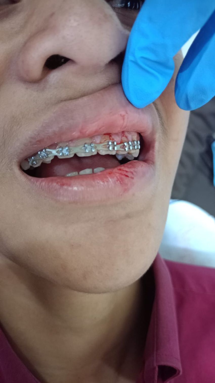Santri Pesantren di Selayang Trauma Berat Usai Dianiaya Temannya Sendiri