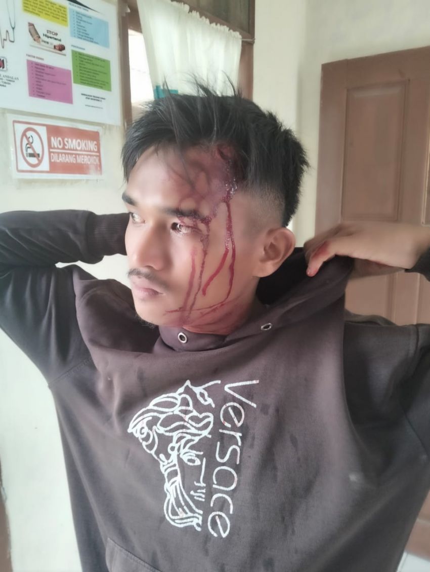 Masyarakat Menilai Kericuhan di Desa Simare Akibat Provokasi LSM