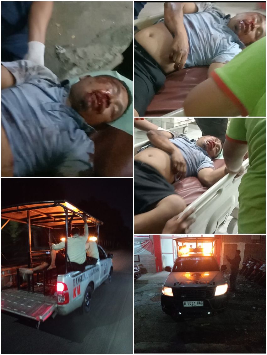 Kecelakaan di KIM,  Korban Alami Luka Serius di Bagian Wajah