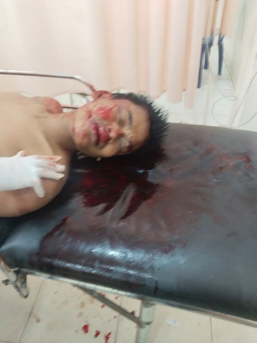 Perkelahian Dua Geng Motor di Kota Tebingtinggi, Seorang Pelajar Kritis Nyaris Tewas