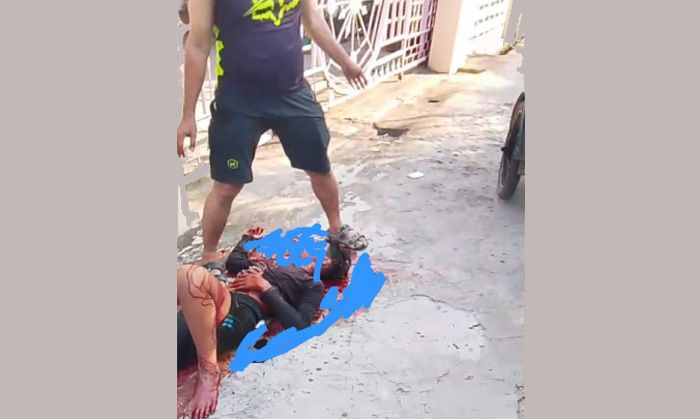 Sedih Kali Rasanya! Anak Yatim Piatu di Brandan Jadi Korban ke-8 yang Digigit Kera Liar
