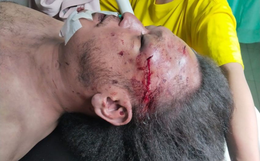 Wartawan Online di Medan Tewas Mengenaskan, Banyak Luka  di Wajah dan Tangan