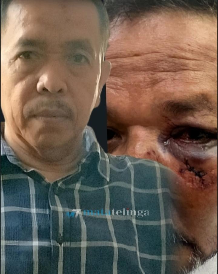 Terdakwa Abdul Aziz Ray Meski Sudah Inkracht, Jaksa Tidak Juga Mengeksekusi