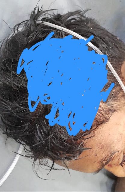 Perang Gengster Belawan, Remaja Tewas Ditembak dan Dibacok